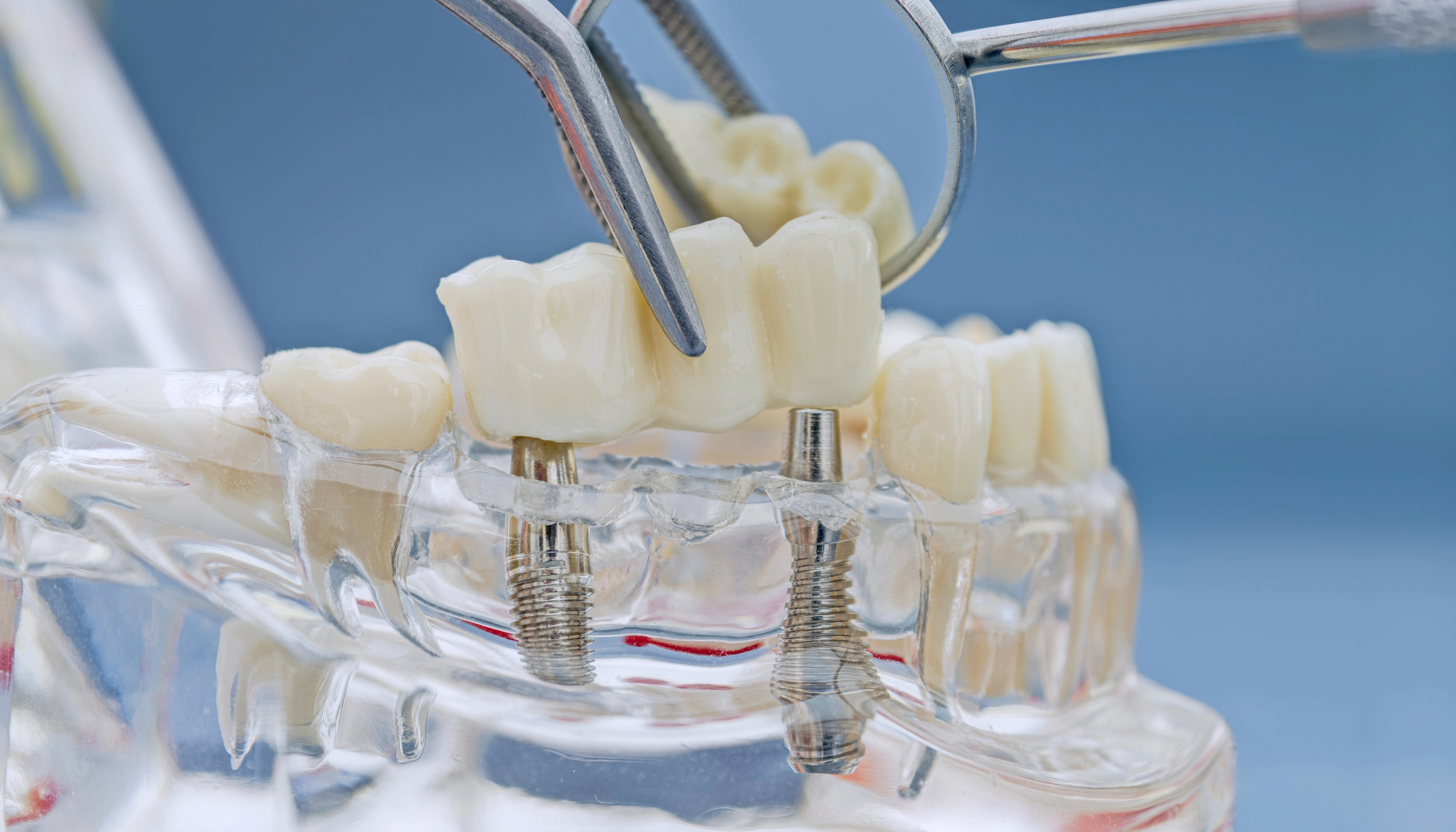 leawood prosthodontic dentistry
