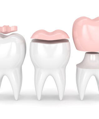 leawood crowns