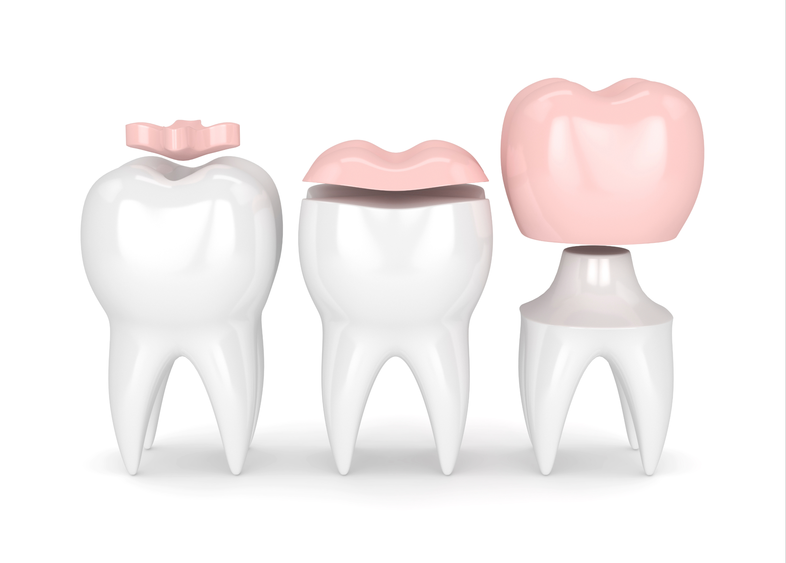 leawood crowns