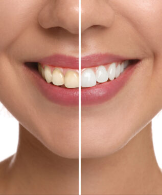 leawood cosmetic dentistry