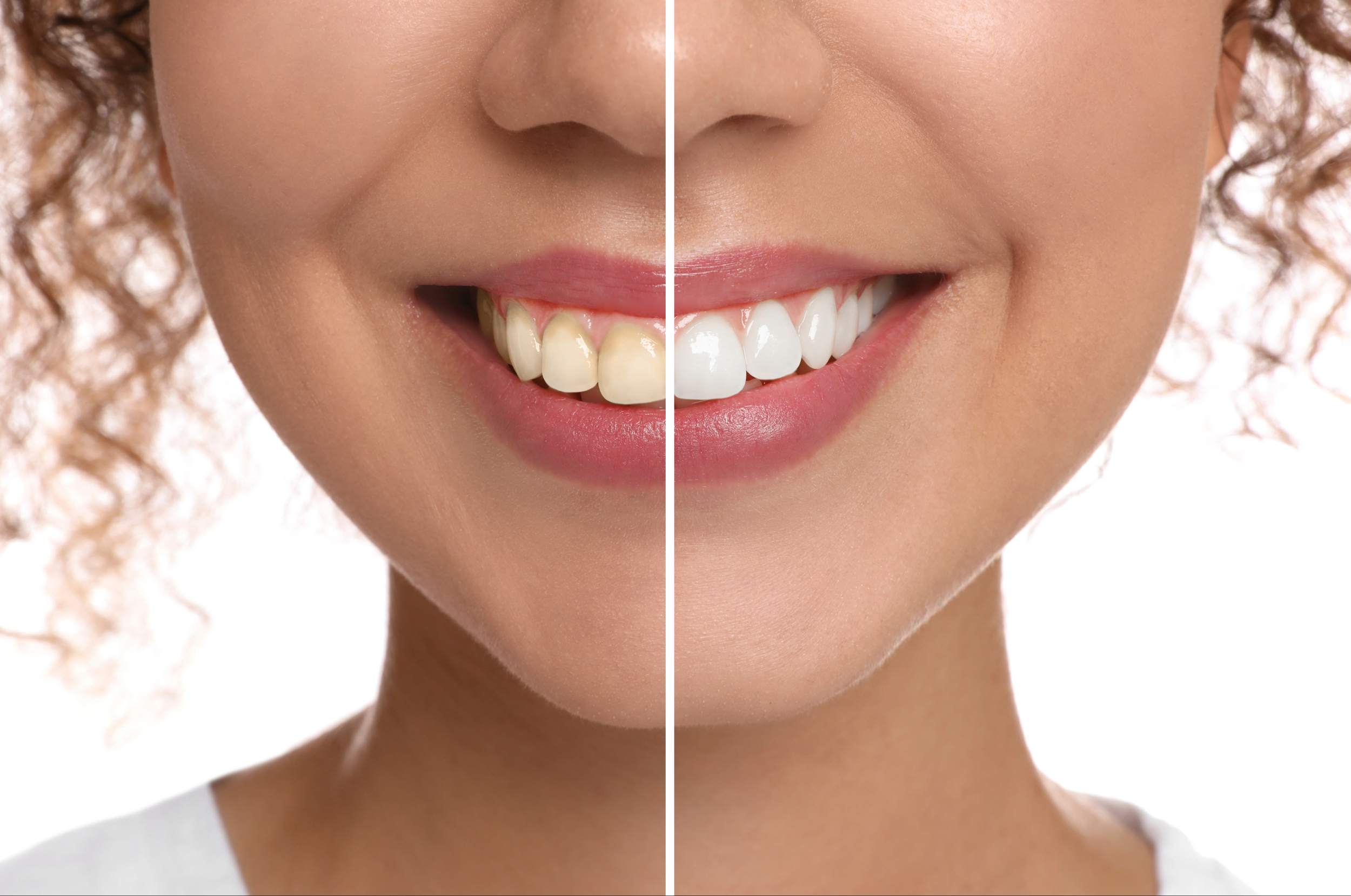 leawood cosmetic dentistry