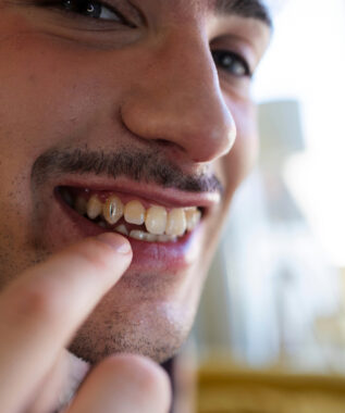 leawood tooth jewelry