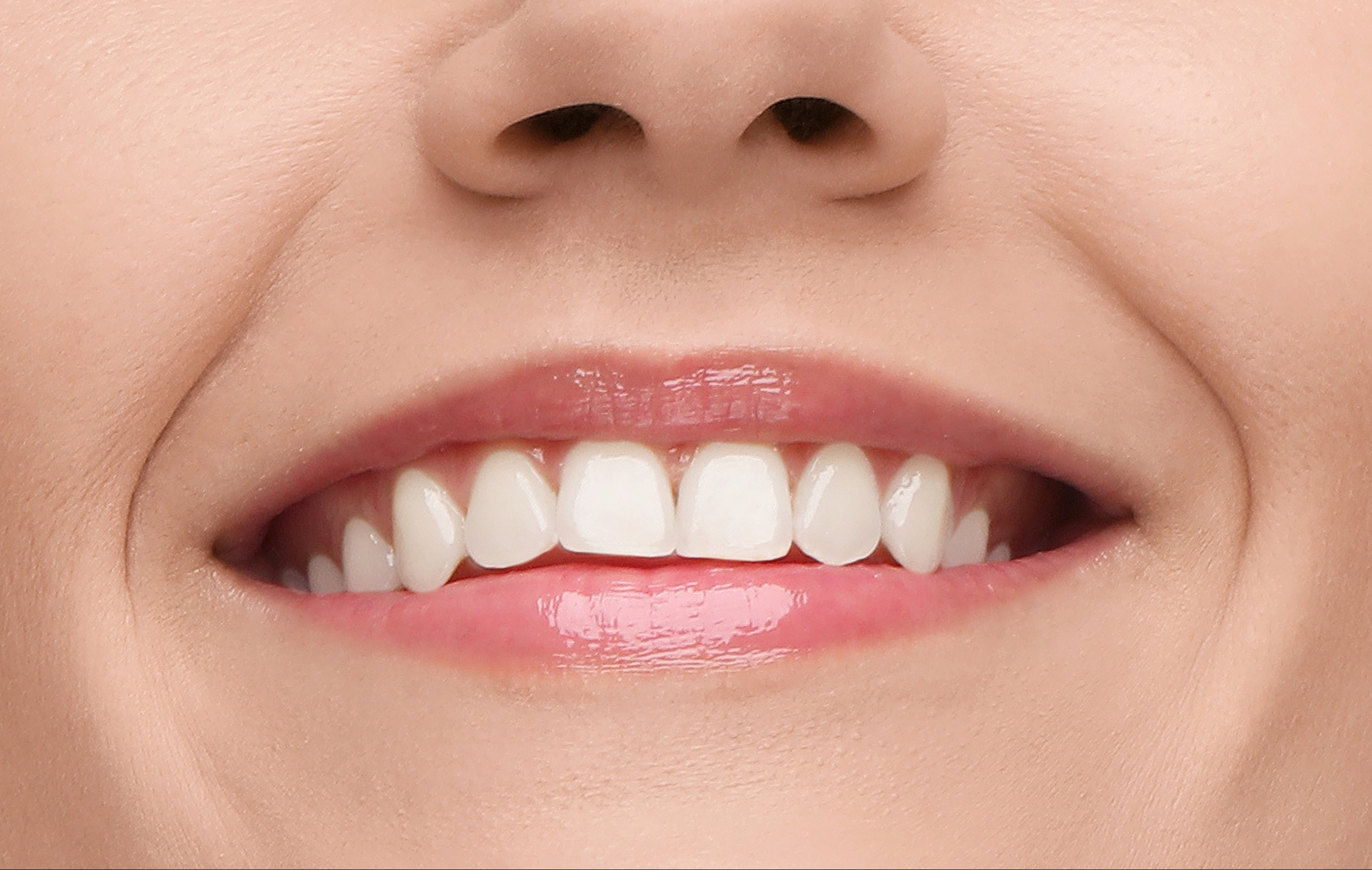 leawood veneers