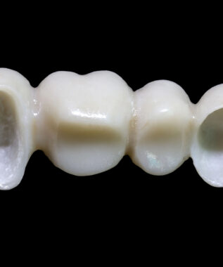 leawood prosthodontic dentistry