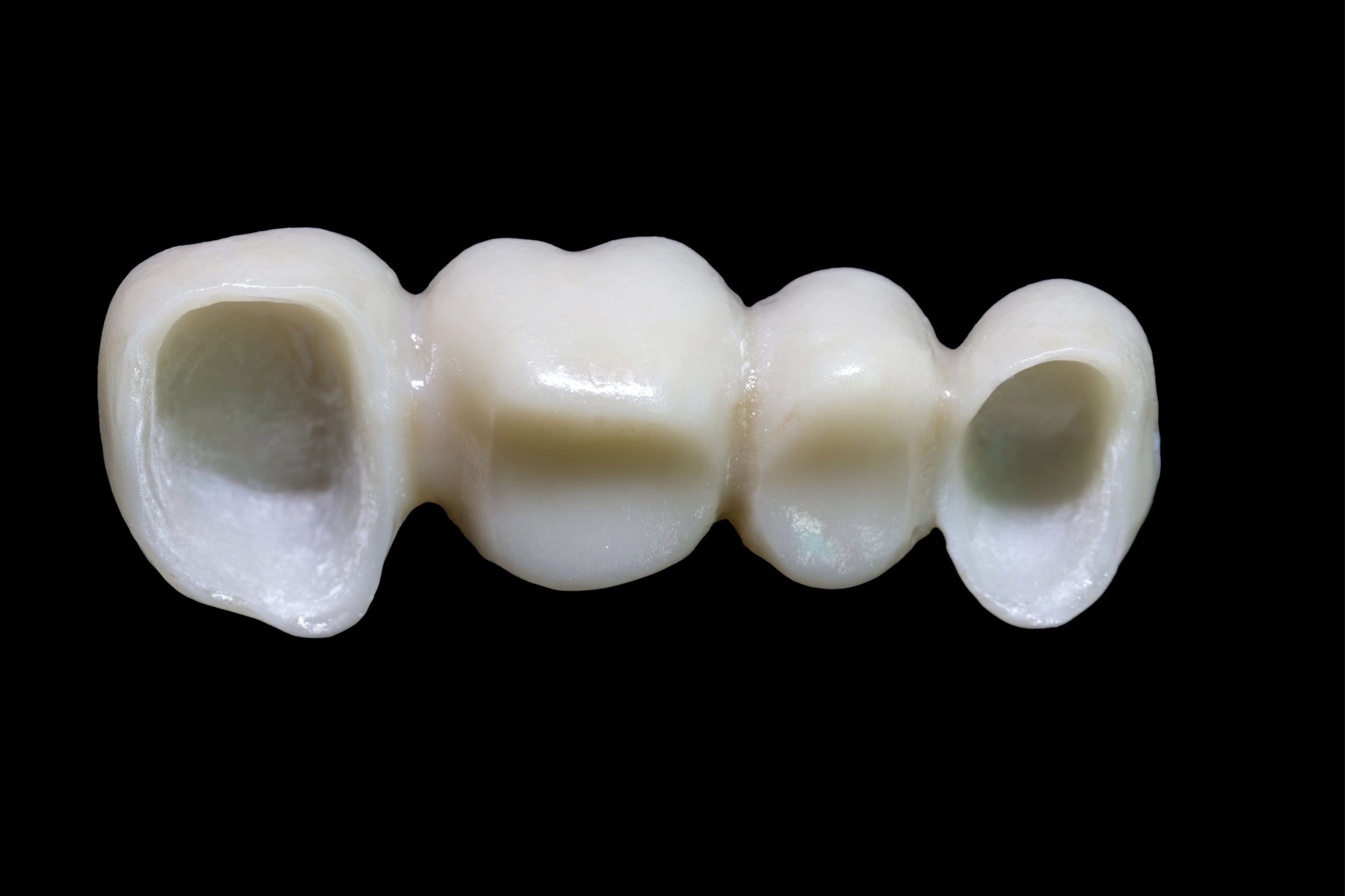 leawood prosthodontic dentistry