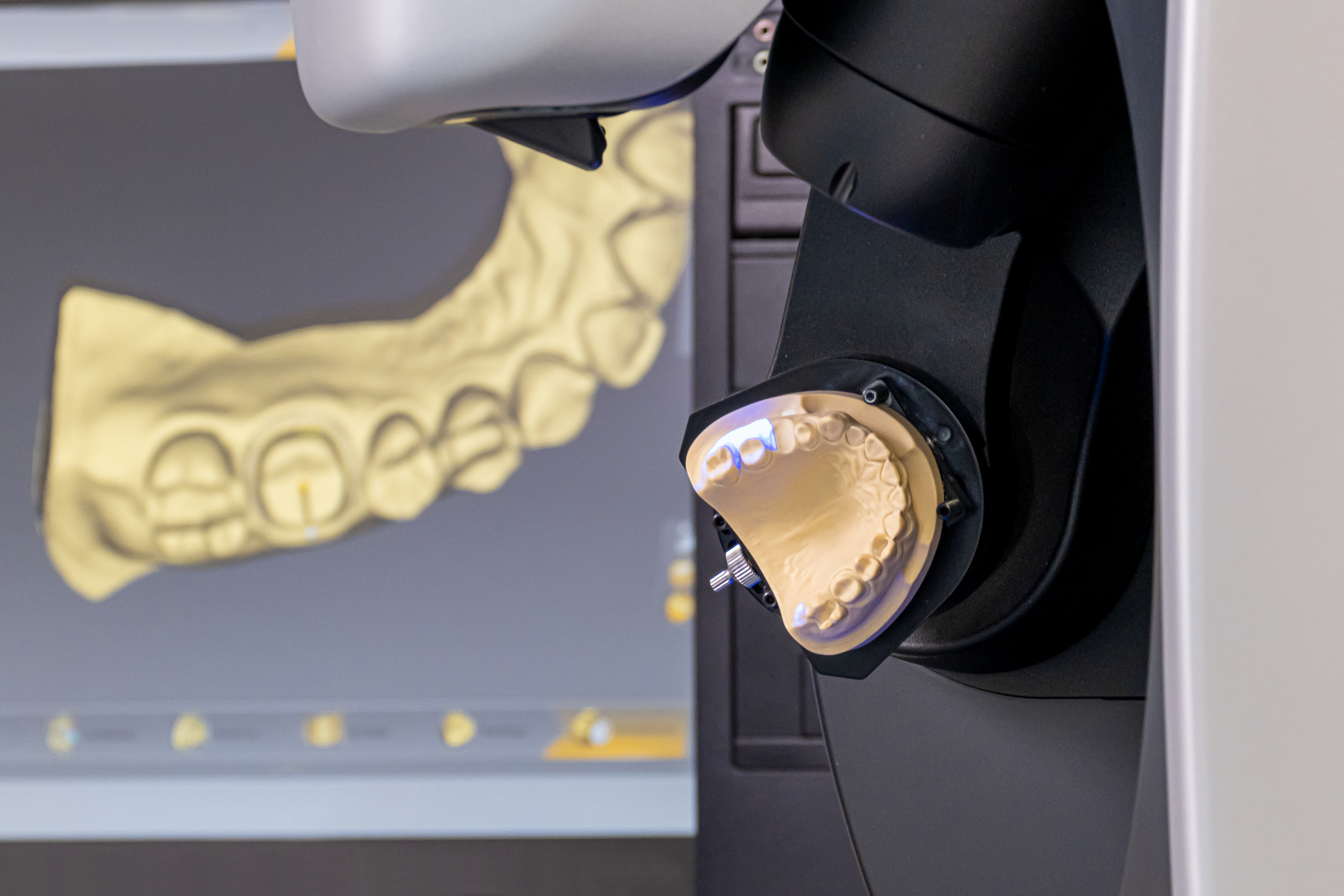 Digital dentures advanced prosthodontic techniques leaood ks